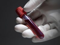 Ferris Advises People On Medical Cards Charged For GP Blood Tests To Seek Reimbursement