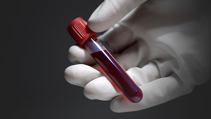 Ferris Advises People On Medical Cards Charged For GP Blood Tests To Seek Reimbursement